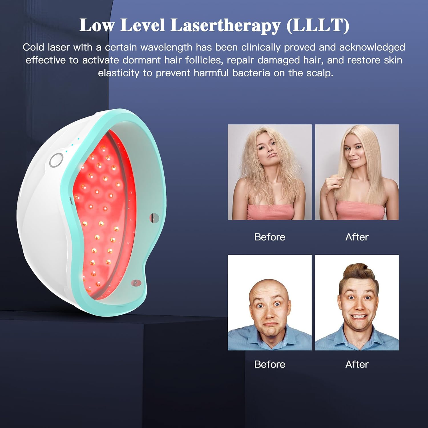 Wireless Laser Therapy Cap for Hair Growth for Men and Women, Laser Hair Growth Helmet & Hat with NO Cable, Hair Loss Treatment of Thinning Hair, Receding Hairline & Postpartum Hair Loss