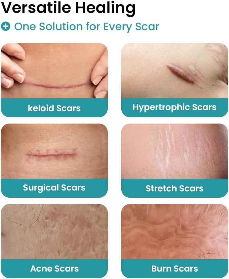 Edmire Silicone Scar Tape &ndash; Soft Reusable Scar Sheets for Surgical Scars, C-Section, Keloid & Burn Marks &ndash; Gentle, Breathable & Waterproof Scar Strips (1.6&rdquo; &times; 60&rdquo; Roll &ndash; 1.5 M, Skin Tone) image number 6