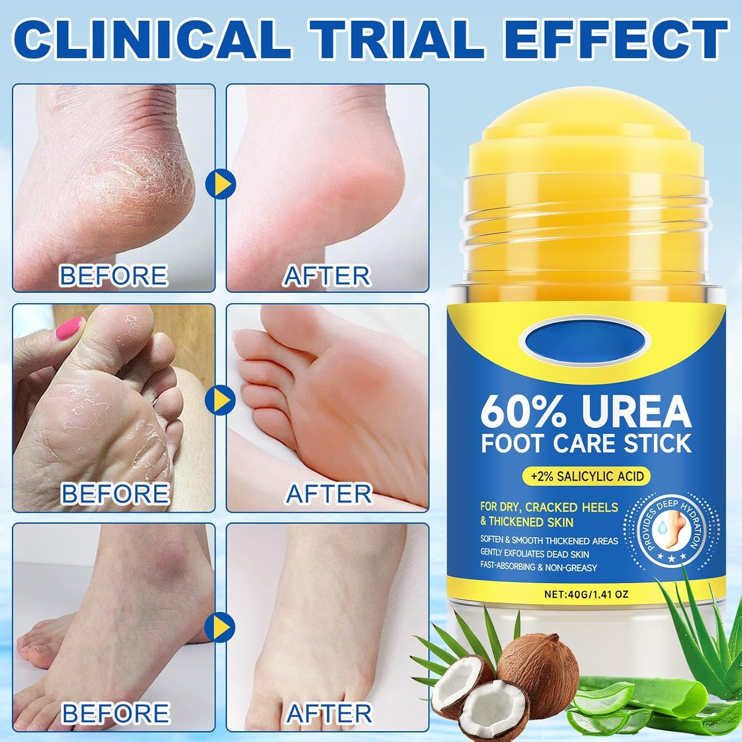 Urea Cream Stick 60% + 2% Salicylic Acid, Exfoliating & Moisturizing Foot Care Stick for Dry Cracked Feet, Hands, Knees & Elbows, Callus Remover & Skin Softener, Fast Absorbing Hydrating Balm (4Pcs) - 1Pcs image number 6