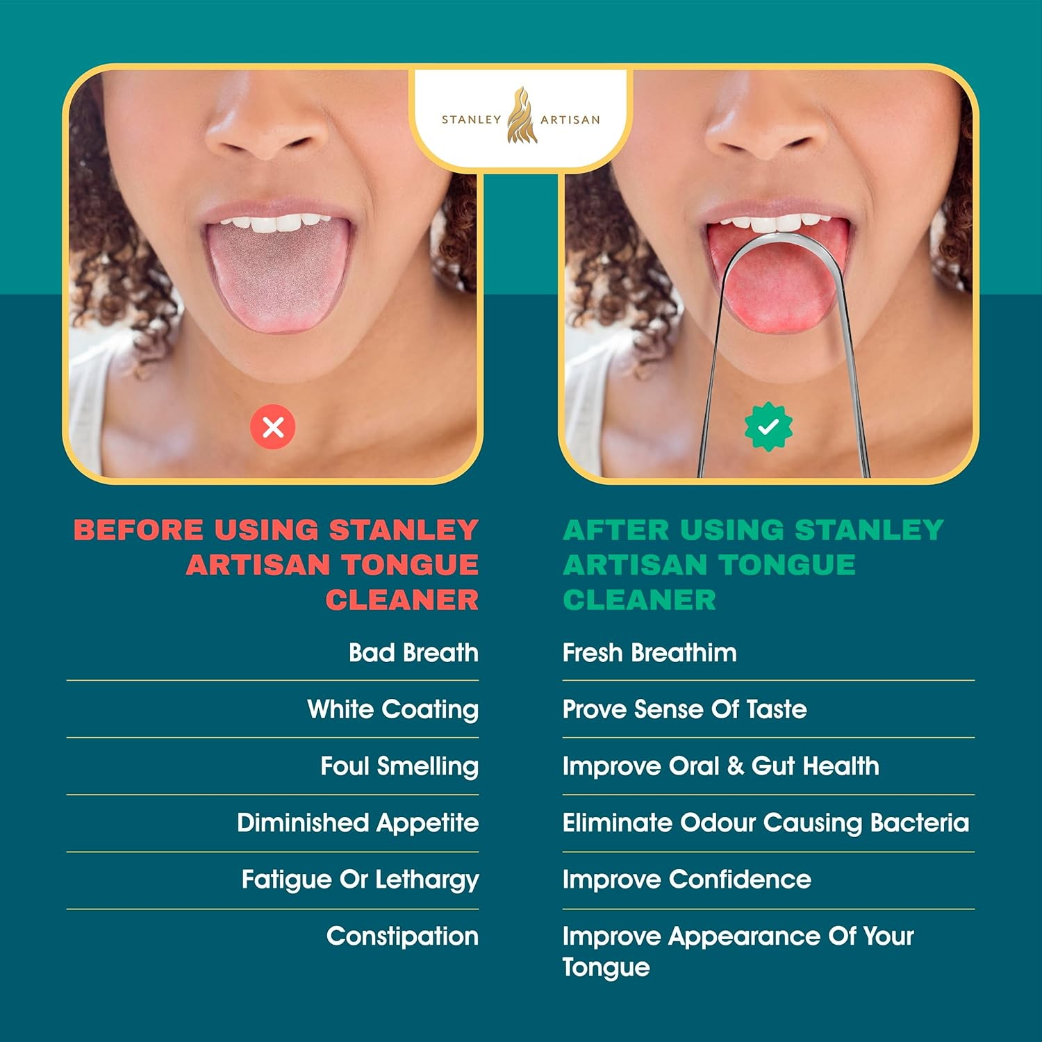 Tongue Scrapers, Professional Tongue Cleaner Scraper, Tongue Cleaner Reusable Stainless Steel Tools with a Ppt Premium Plastic Case - for Adults 1 Count (Pack of 1) image number 4