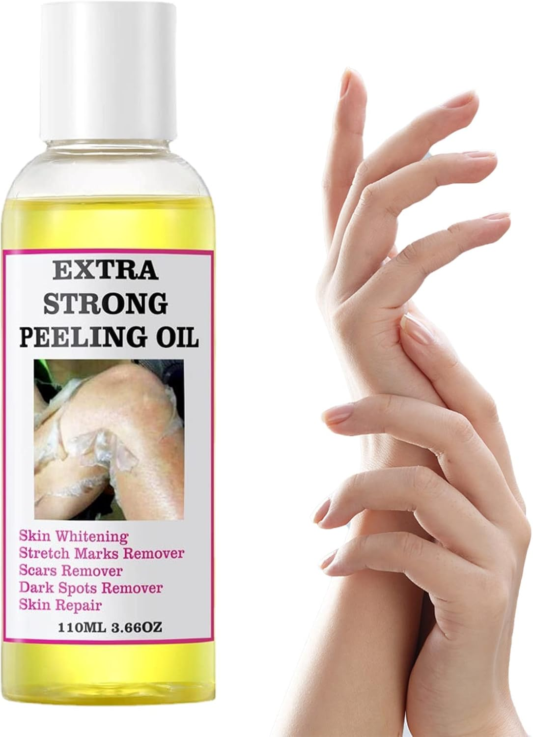 2 Skin Peeling Exfoliator | 110Ml Portable Effective Yellow Peeling Oil, Skin Peeling Solution Multi-Use Spot Correcting and Brightening Oil for Elbows, Knees, Fingers Puchen
