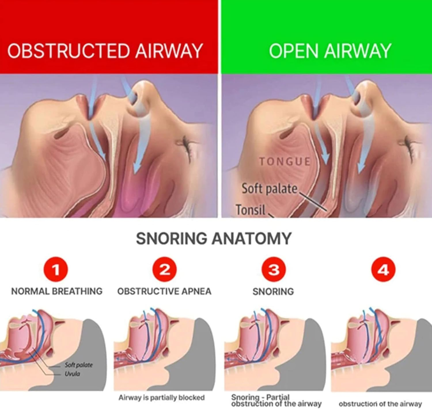 Mouth Guard for Teeth Grinding with anti Bruxism Sleeping Aid Mouth Guard for Men/Women a Better Night'S Sleep Bring Braces Box image number 4