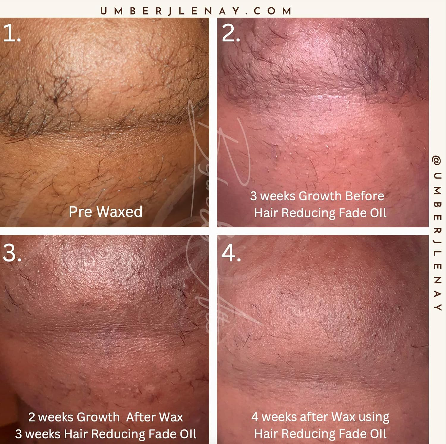 Umber by J. Lenay Hair Reducing Fade Oil &ndash; Regular Strength (Not Sensitive Skin), Minimizes Hair Growth for Face & Body &ndash; for Women & Men &ndash; 15Ml Serum image number 1