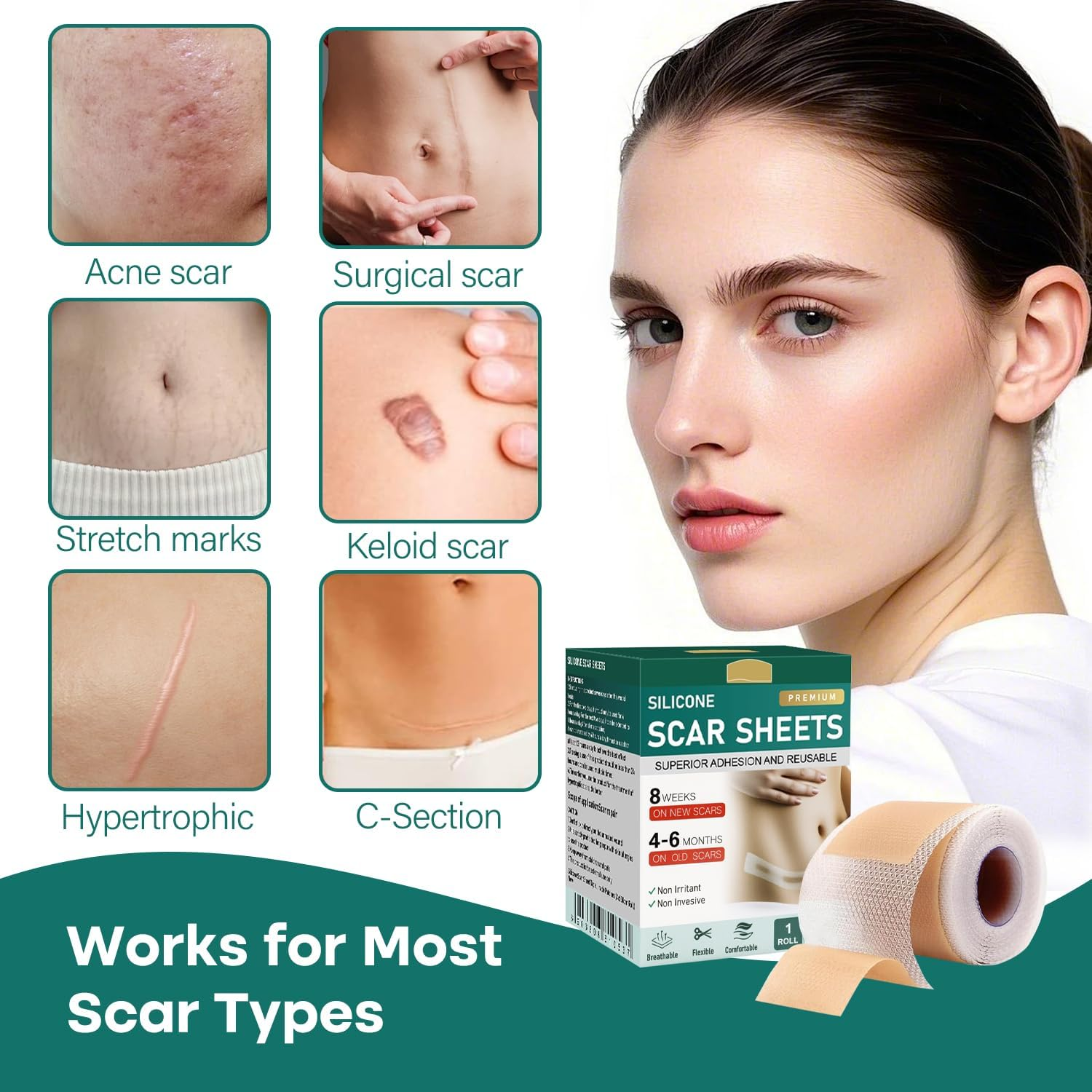 Silicone Scar Sheets(1.6'' X 60''Roll-1.5M), Necomi Professional Silicone Scar Tape Roll, for Softening & Flattening Scars, Reusable Scar Removal Strips for C-Section, Keloid, Burn, Acne, Surgical image number 1