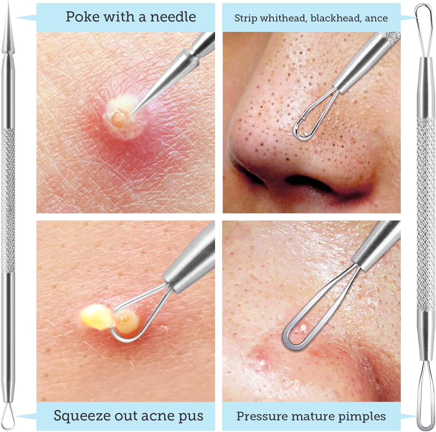 Litbear Pore Prep Tool, Blackhead Remover Pimple Popper Tool Kit, Stainless Steel Blackhead Extractions Tool for Acne, Whitehead Popping, Blemish, Comedone - Black image number 1