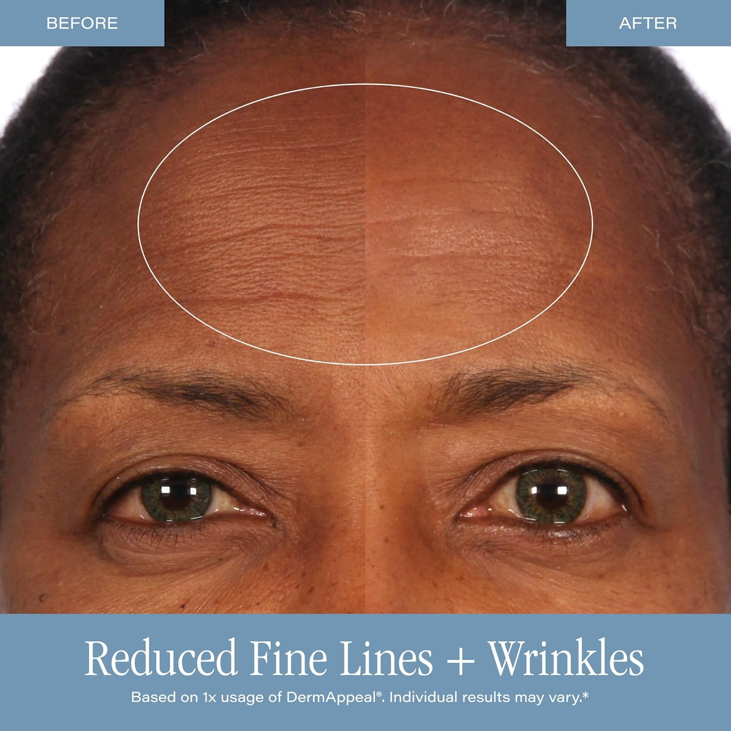 Dermappeal by SKINN Thermo-Enzymatic Microdermabrasion Treatment (Tube) 57Ml 2.0Oz image number 4