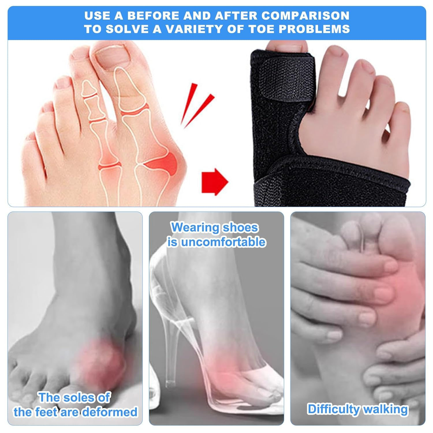 Bunion Corrector for Women & Men, Orthopedic Bunion Splint for Hallux Valgus Pain Relief, Big Toe Separator, Adjustable Day/Night Support, Comfortable Hammer Toe Straightener（2Pack） image number 5