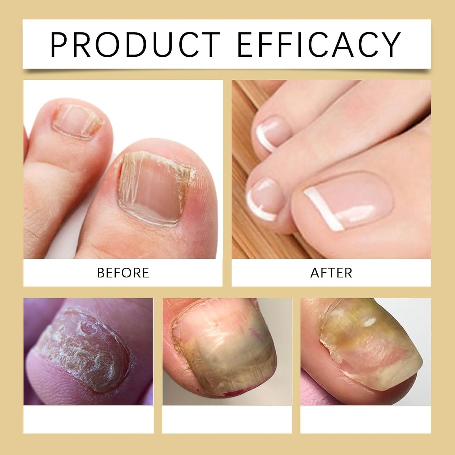 Keratin 3 Day Nail Care Oil,Daily Keratin Caring Cuticle Serum, Active Gloss Nails Polish,Thickness Hard Growth Oil,Moisturizes Strengthening Damaged Weak Dry Cracked Brittle (4Pcs) - 4Pcs image number 3