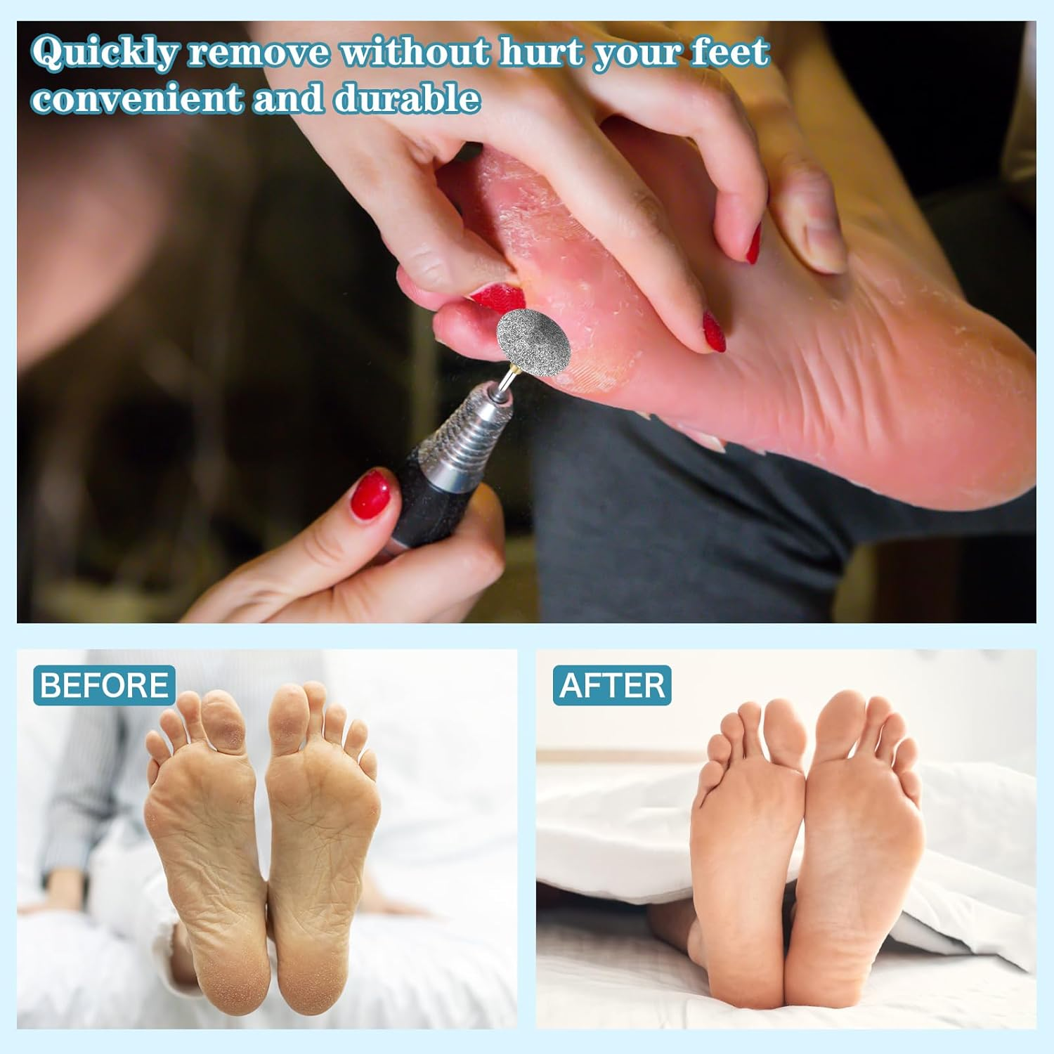 C12Rtive Pedicure Drill Bit, Diamond Carbide Foot Nail Drill Bit,Stainless Steel Professional Pedicure Foot Calluses Sanding Polishing Bits for Cracked Skin Callus Removal for Home Salon & Diy(Coarse)