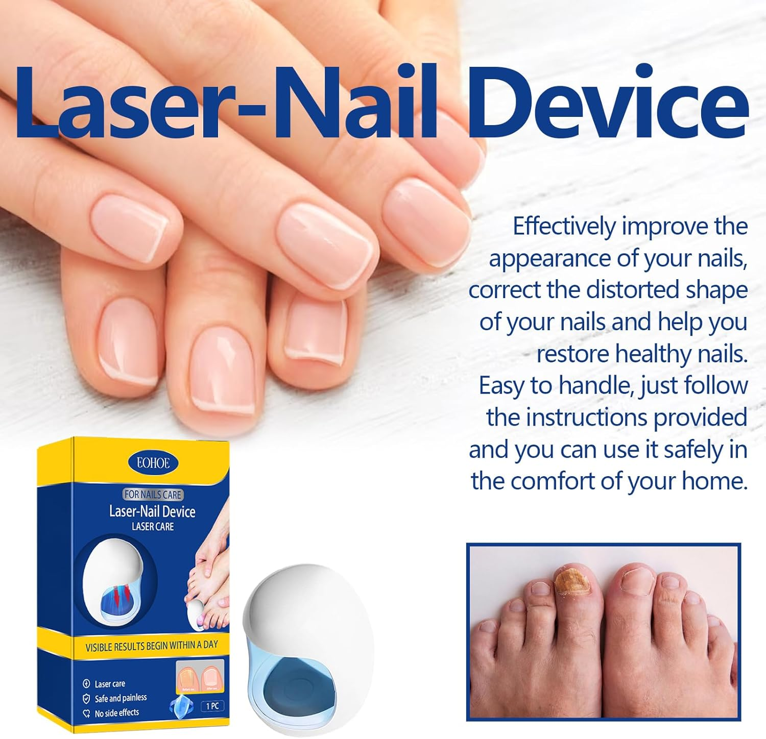 Mingzhe Laser-Nail Device Nail Fungus Cleaning Laser Device Nail Fungus Laser Treatment for Damaged Discolored Thick Toenails & Fingernails image number 4
