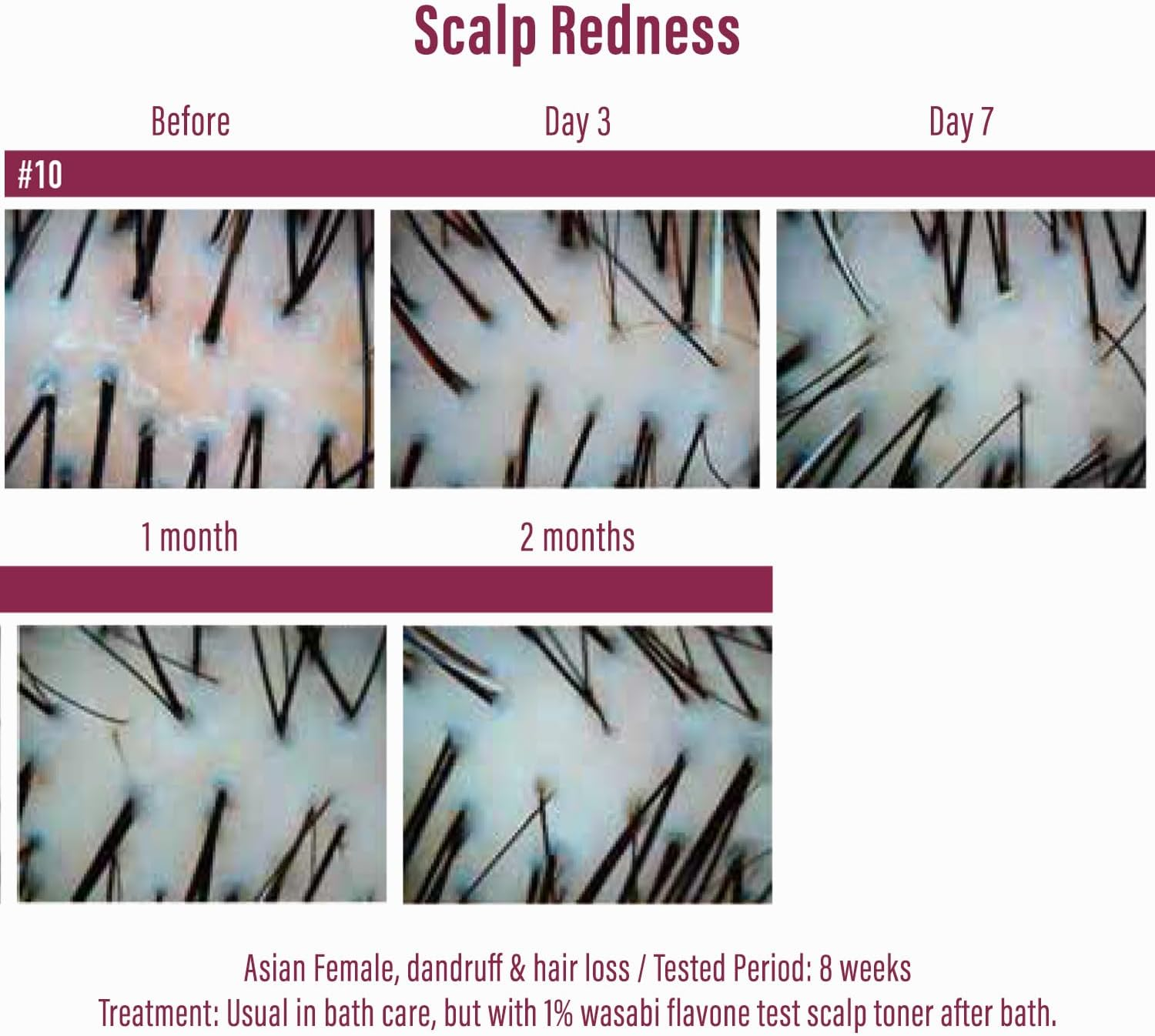 Naturelab Moist Diane Perfect Beauty Extra Hair Fall Control Shampoo 450 Ml image number 6