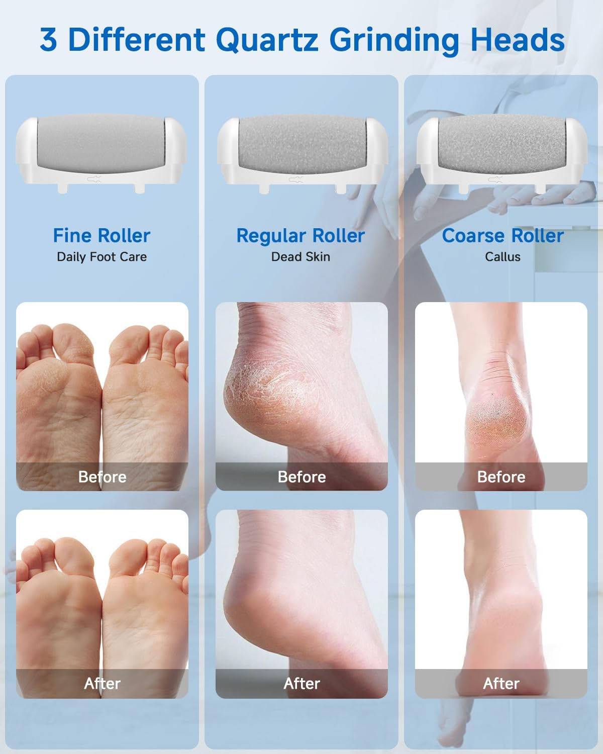 Electric Callus Remover - Callus Removal Foot Electric - Electric Callus Remover with 3 Gears, 6 Replacement Rollers, Waterproof Foot File for Cracked Heels, Callus Removal (White-6) - White image number 7