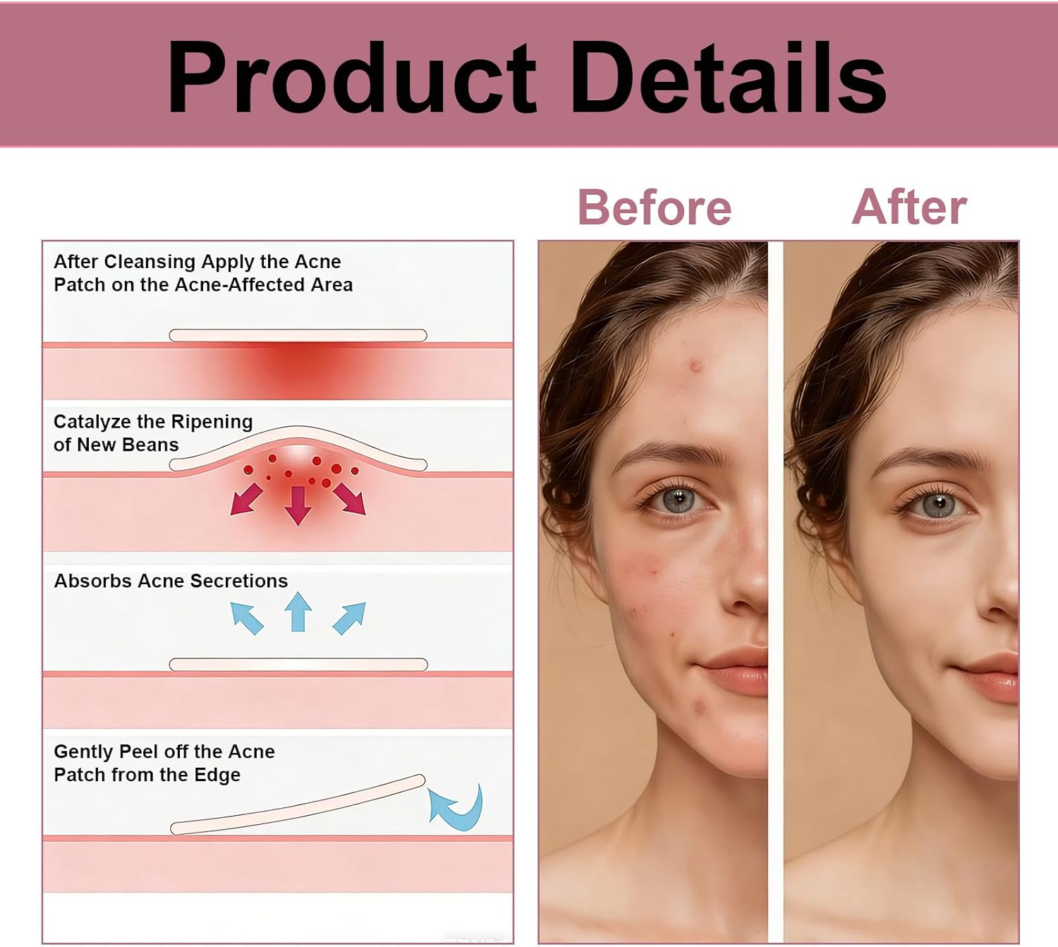 400 Pcs Pimple Patches for Face, Hydrocolloid Patch Starface Pimple Patches with Tea Tree Oil for Day and Night Use, Invisible Zit Targets Suitable for Young People, Student, Stay up Late, Traveling image number 4