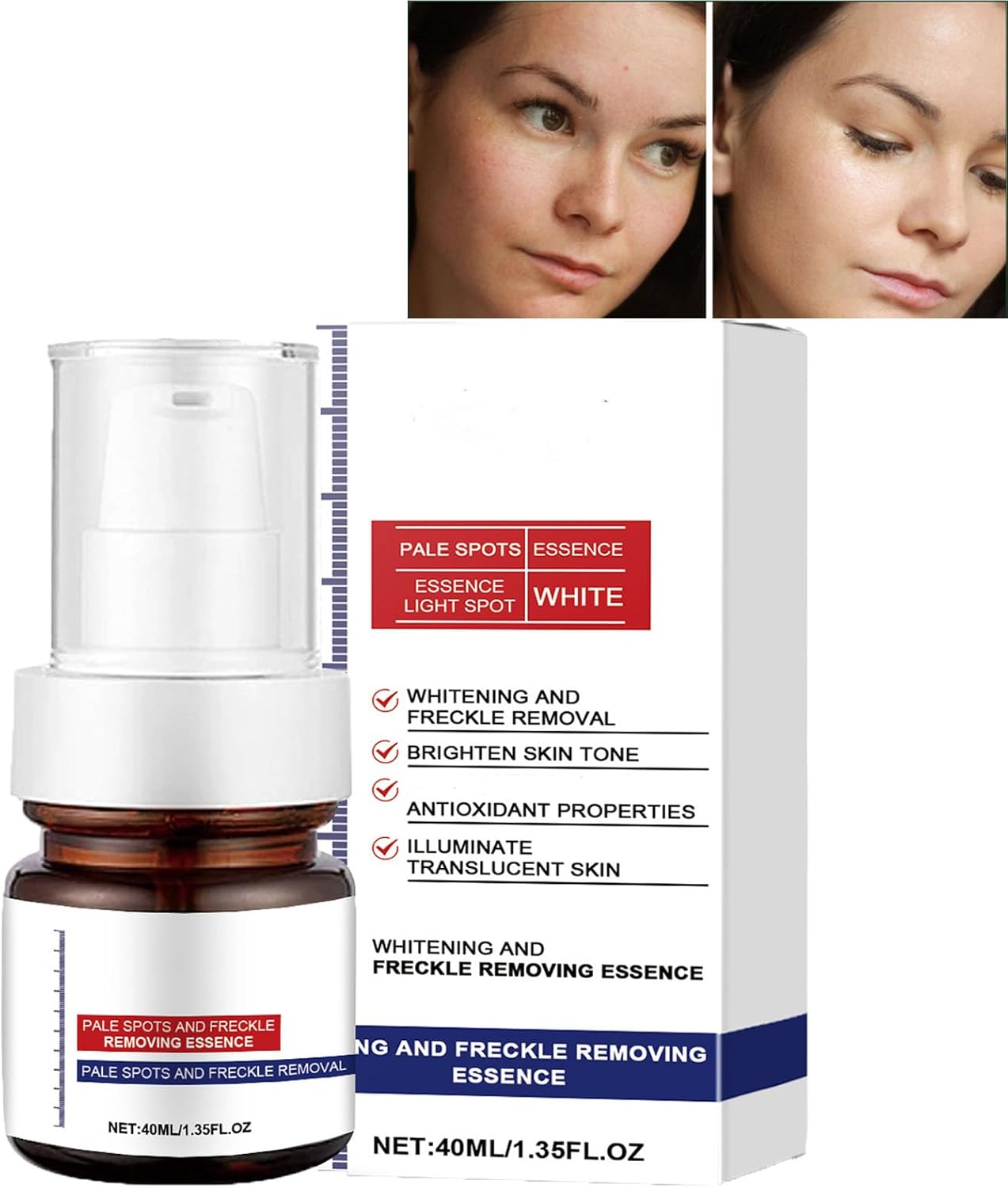 Whitening and Freckle Removing Essence, Anti-Spot Serum, Spot Remover for Face, Freckle Removing Essence, Dark Spot Correcting Serum, Skin Tightening Cream (1Pcs) image number 3