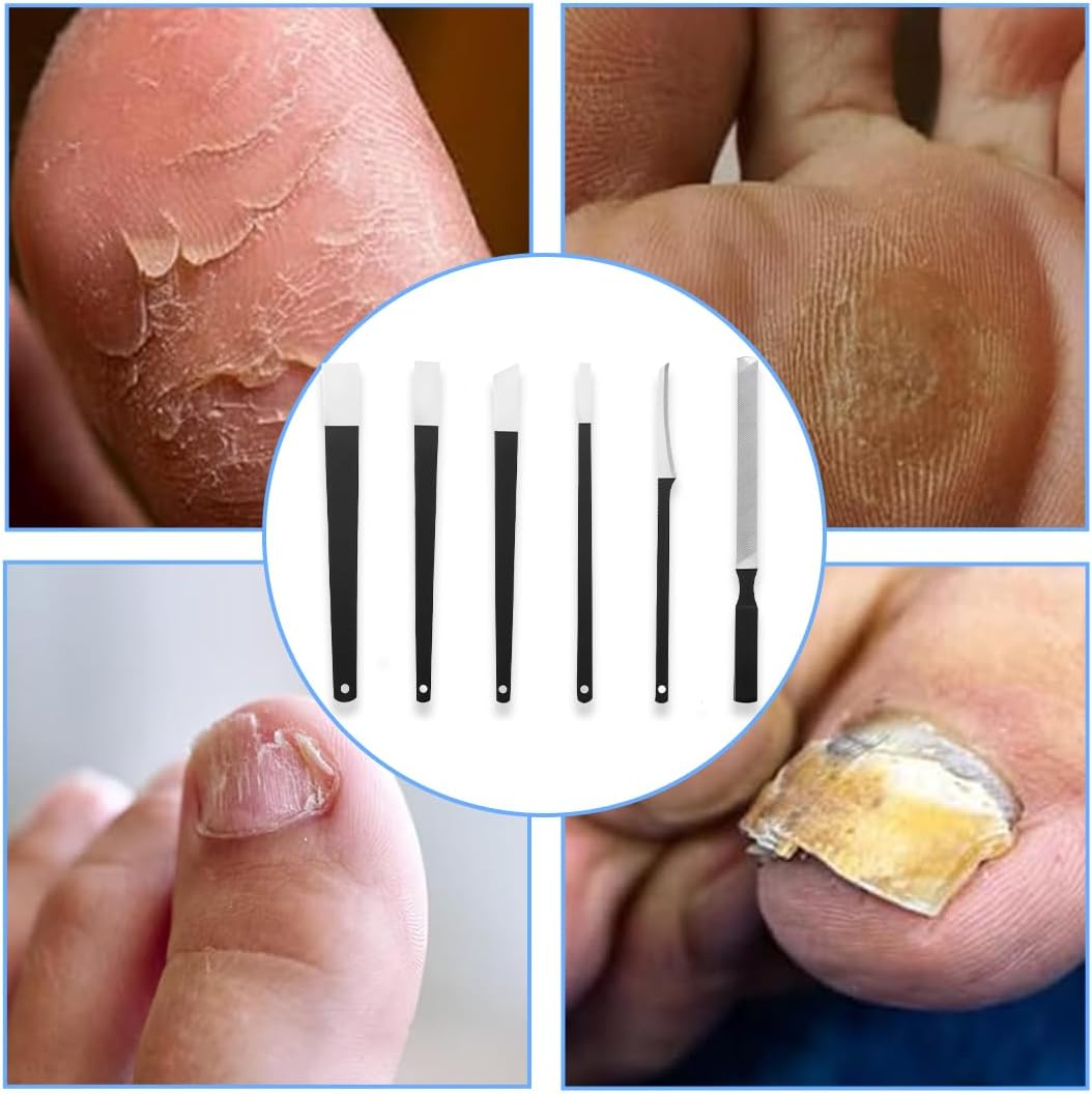 JEYORZY 6-Piece Ingrown Removal Set, Stainless Steel Pedicure Knife Kits with Storage Box, Callus Remover, Callus Remover, Foot Scraper, Pedicure Knife Kits, Foot Care Tools for Hand Feet