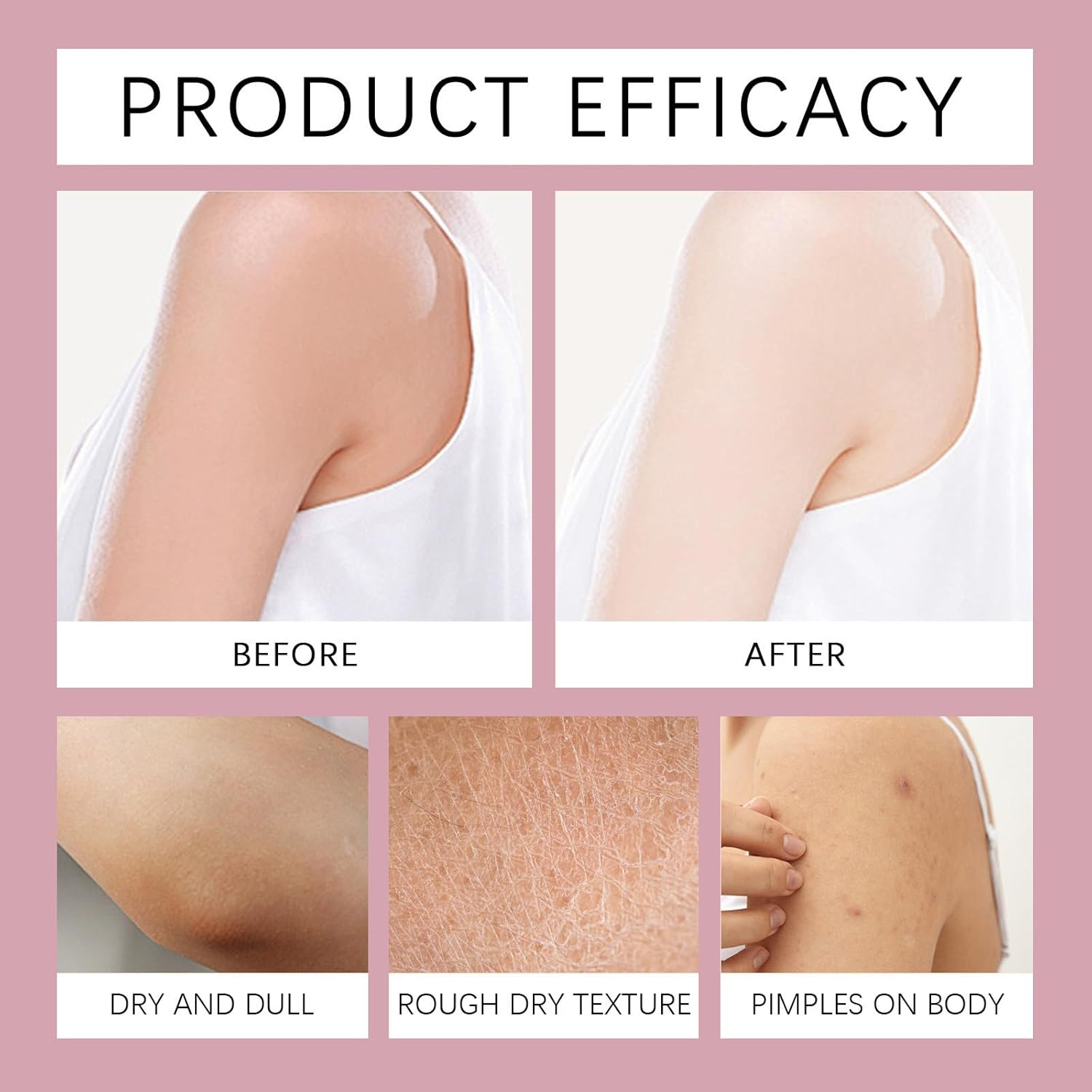 Strawberry Skin Resurfacing Cream, Strawberry Body Lotion for Dry Skin, Strawb/Erry Brightening Cream, Moisturizing Bumpy Sk/In There, Reduce Uneven Texture, Silky and Smooth S/Kin Effect (1 PCS)