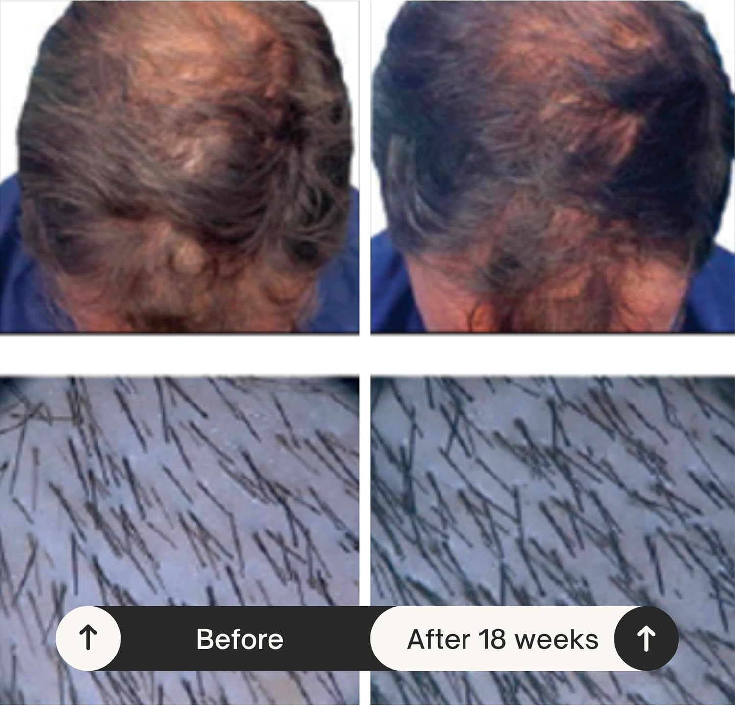 Rausch Caffeine Shampoo with Ginseng 200Ml -Relief for Hair Loss. image number 4