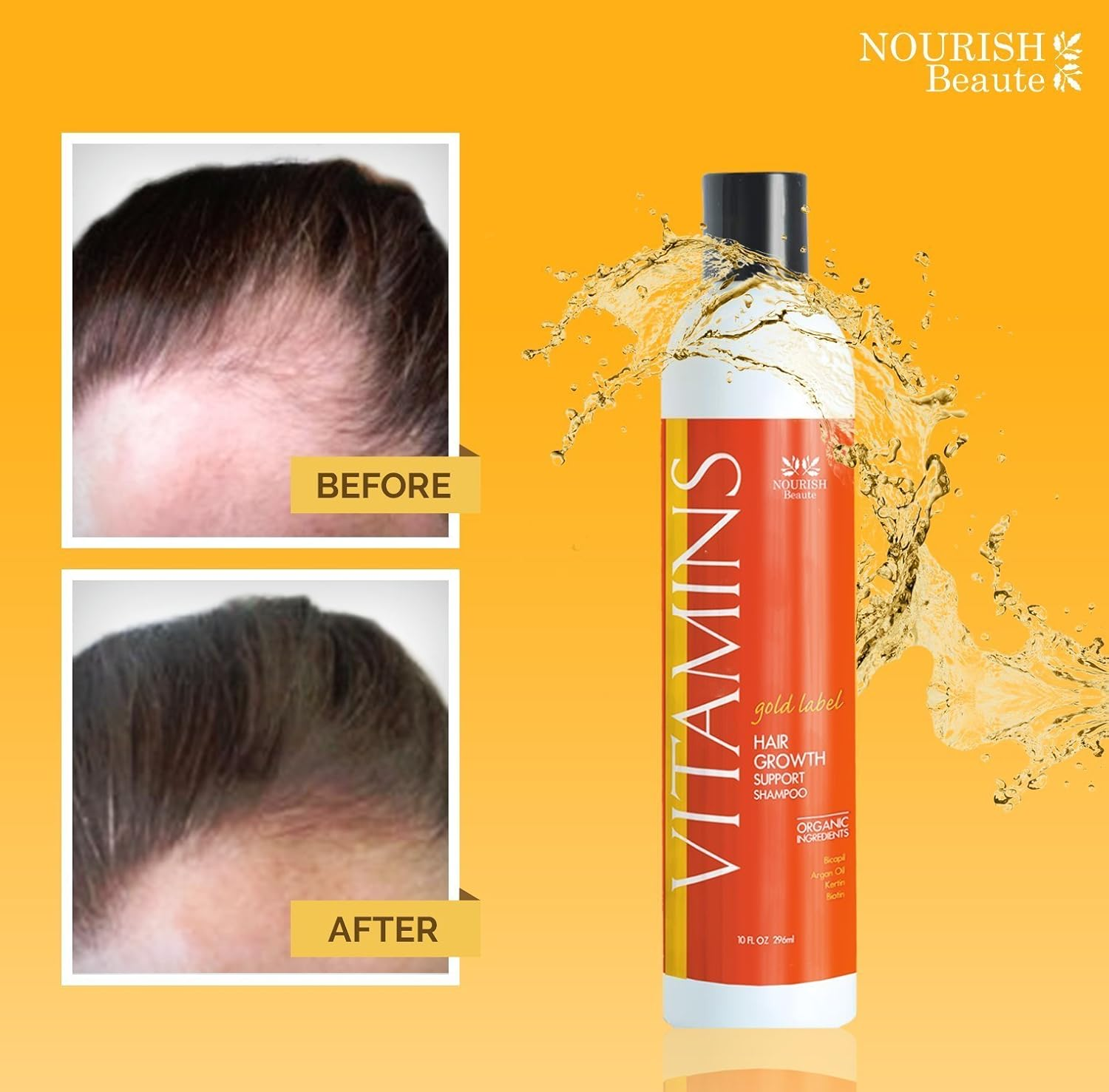 Nourish Beaute Vitamins Premium Shampoo for Hair Loss That Promotes Hair Regrowth, Volume and Thickening with Biotin, DHT Blockers, Antioxidants and Oils, for Men and Women, 2 10 Ounce image number 4