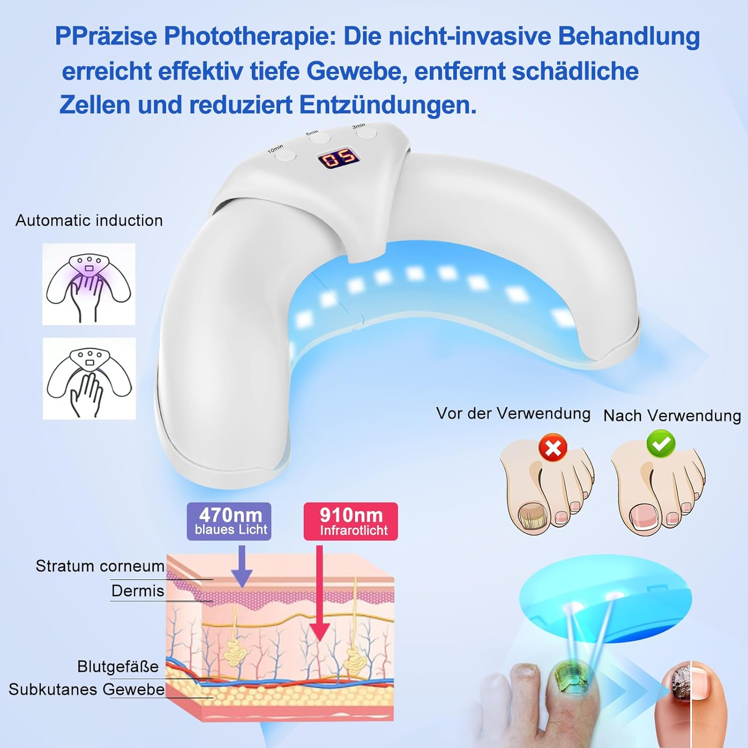 Nail Fungus Cleaning Device for Multiple Toenail,Suitable for Discolored and Thickened Toenails,Foldable 910 Nm Infrared Light + 470Nm Blue Light Nail Fungus Treatment Device,Safe & Effective image number 6