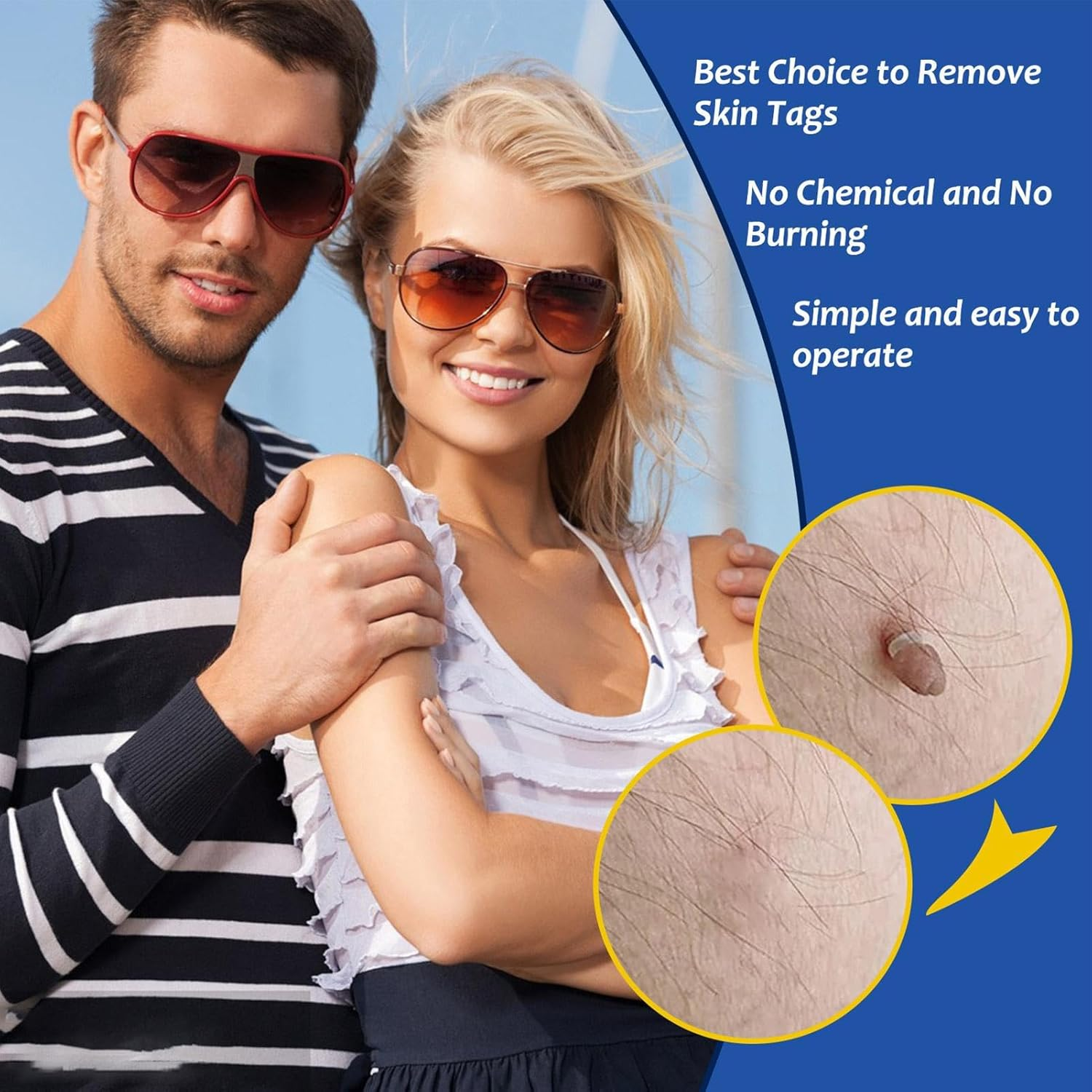 Skin Tag Remover Tools, Wart Remover Pen, Skin Tags Device for Small/Large Tags(4-9Mm), with Removes Cone-Shaped, Cleansing Pads, Patches, Instruction Manual image number 6