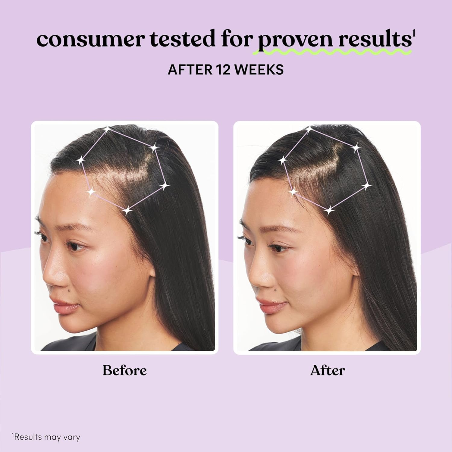 Lemme Grow Hair Growth Supplement for Women, Clinically Proven Keratin Complex for Visibly Thicker Hair and Scalp Coverage, Reduced Shedding, Nourish Thinning Hair - 1 Month Supply image number 4