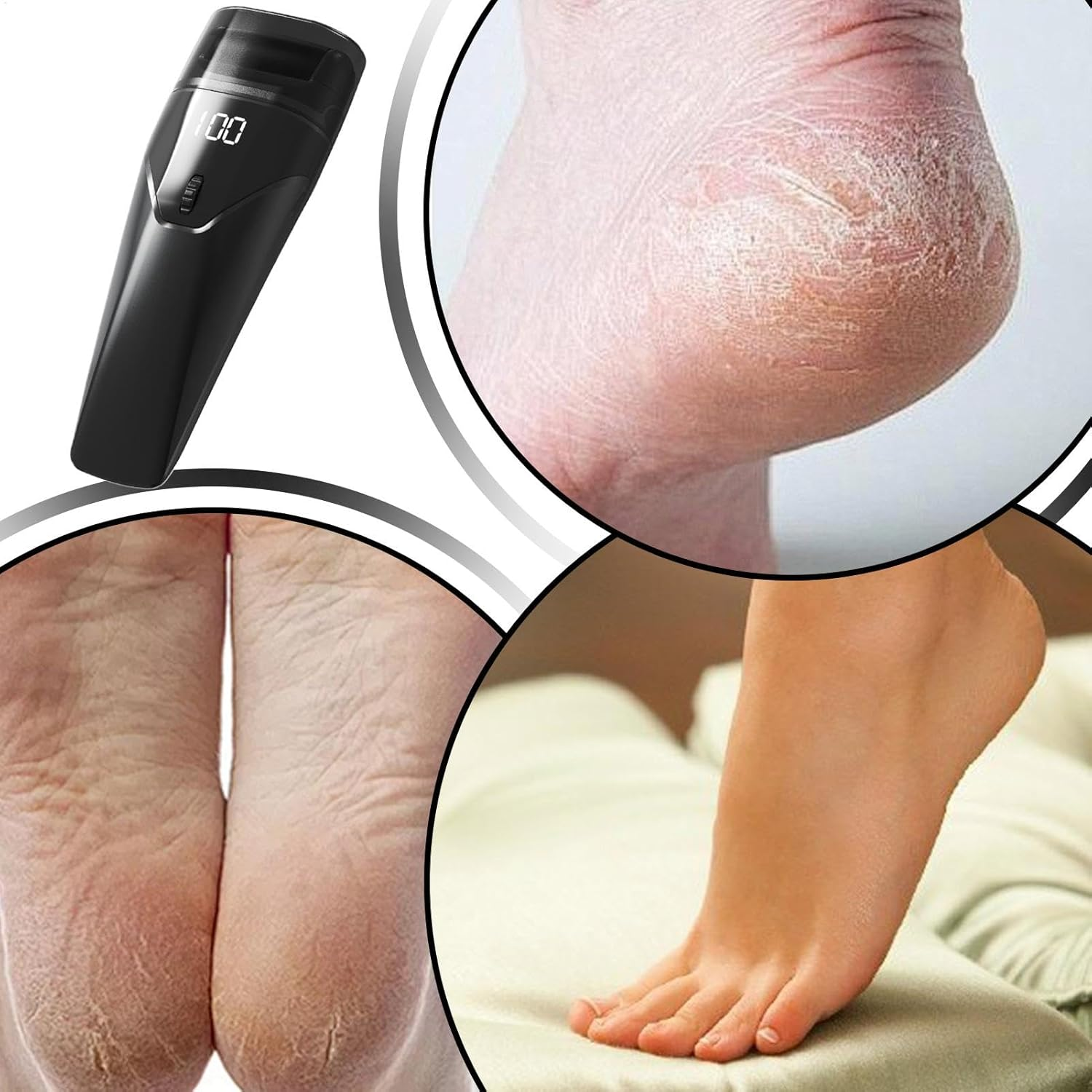 Foot Scrubber Electric | Scrubber Electric Foot File USB Charging - Men Women Pedicure Tool Feet Scraper with Auxiliary Light for Student Dormitory, Travel