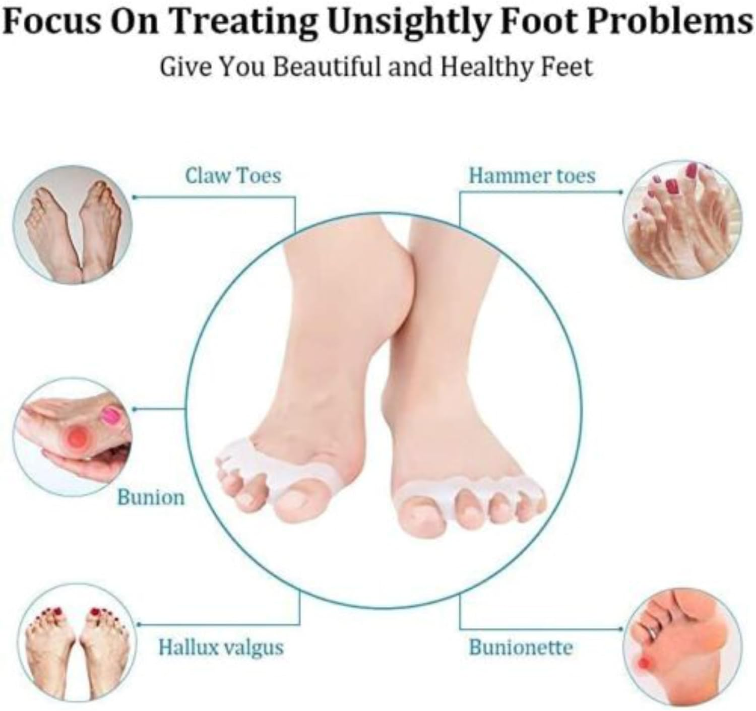 Gel Toe Separator, MH MOIHSING Toe Spacers Rubber Toe Stretchers Used for Sports Activities, Yoga Practice & Running for Men and Women Bunion Pain Relief Toe Straightener Achilles Stretcher (2 Pair) image number 6