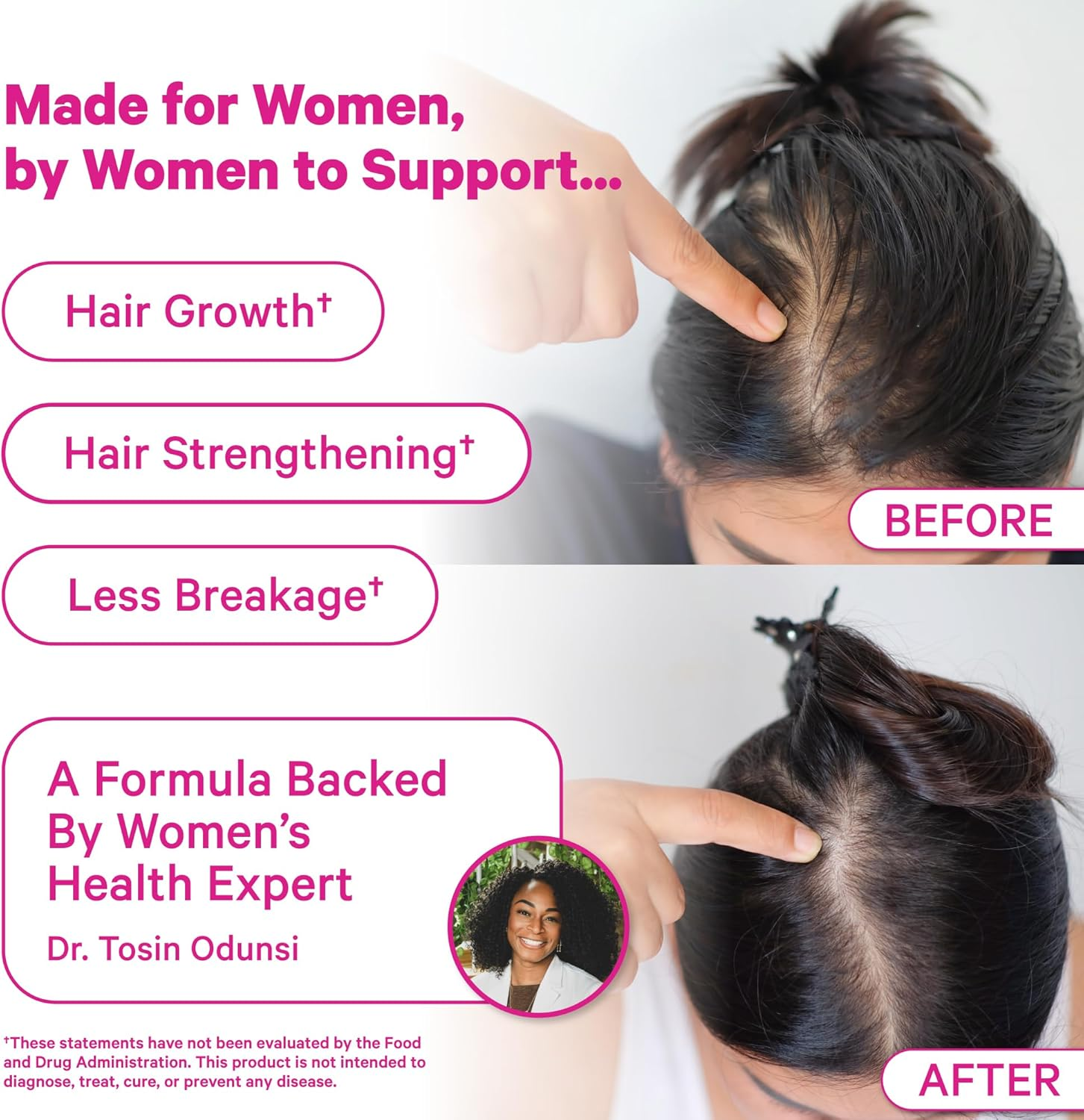 Pink Stork Postpartum Hair Loss Gummies: Hair Skin and Nails Vitamins, Postnatal Vitamins, Biotin for Hair Regrowth + Strengthening, Postpartum Essentials for Moms, Women-Owned, 60 Strawberry Gummies image number 2