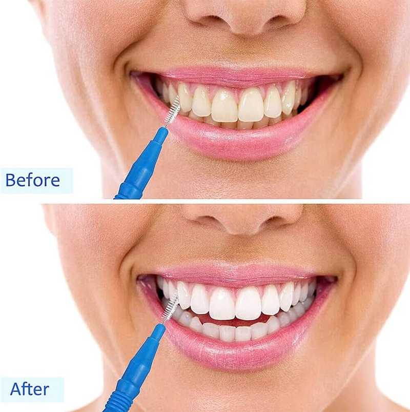 20 PCS Premium Interdental Cleaning Brushes - Floss Head Toothpicks for Optimal Dental Hygiene, Durable & Gentle image number 4