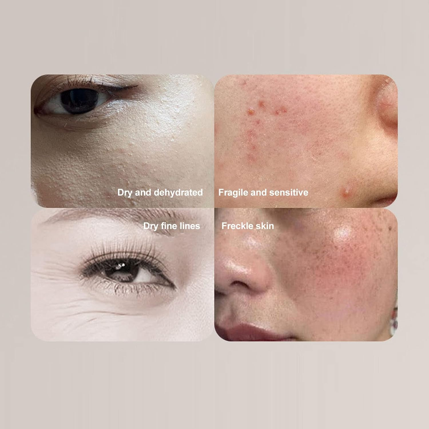 Skin Analyzer Moisture Tester, Portable Handhold Facial Moisture Meter, Skin Care Water Oil Tester Detector, USB Digital Moisture Sensor for Beauty Salon Spa Home Traveling image number 1