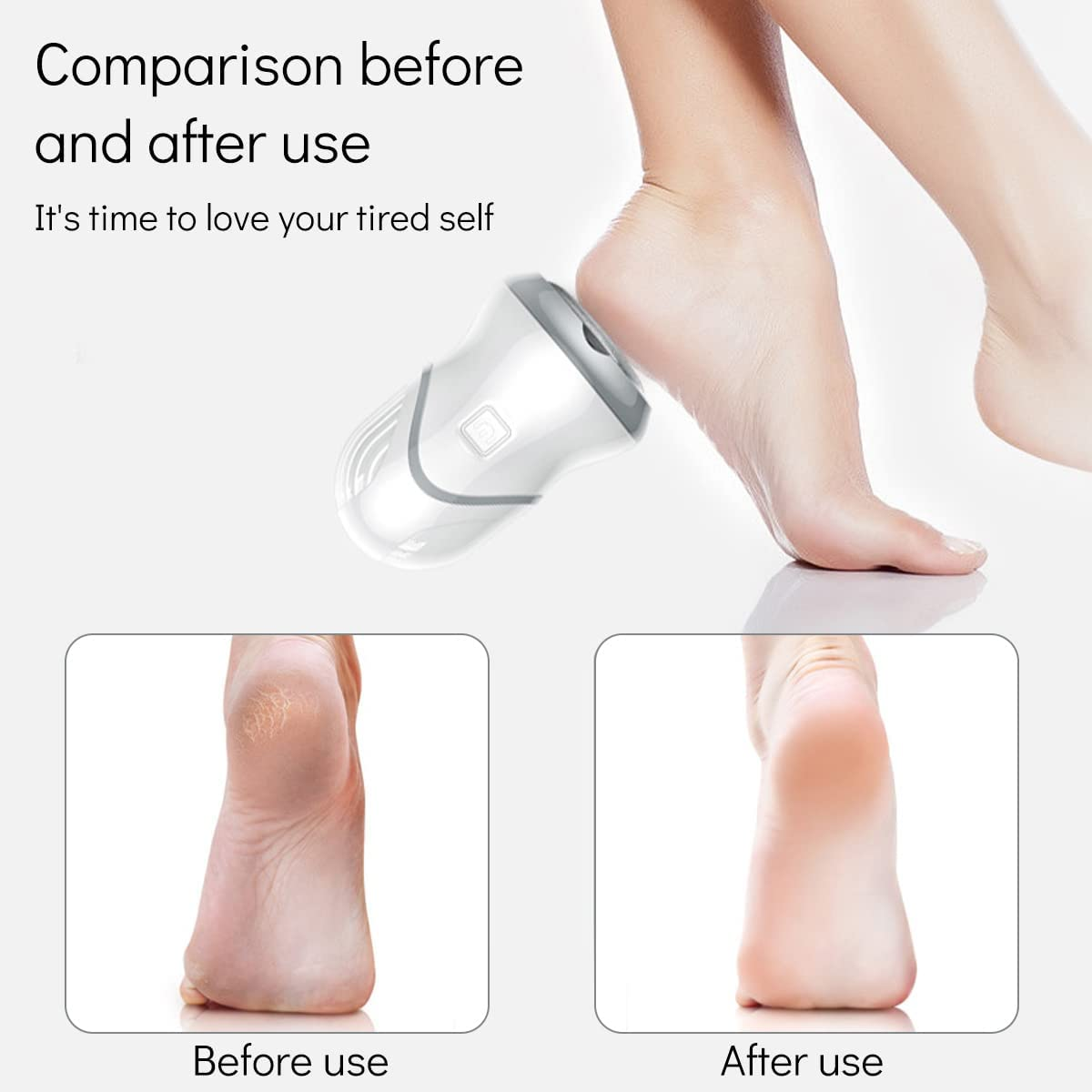 Electric Feet Callus Remover Portable Rechargeable Foot Grinder Foot File Pedicure Tools with Vacuum Adsorption Pedicure Foot Care Tools for Feet Cracked Heels and Dead Skin image number 3