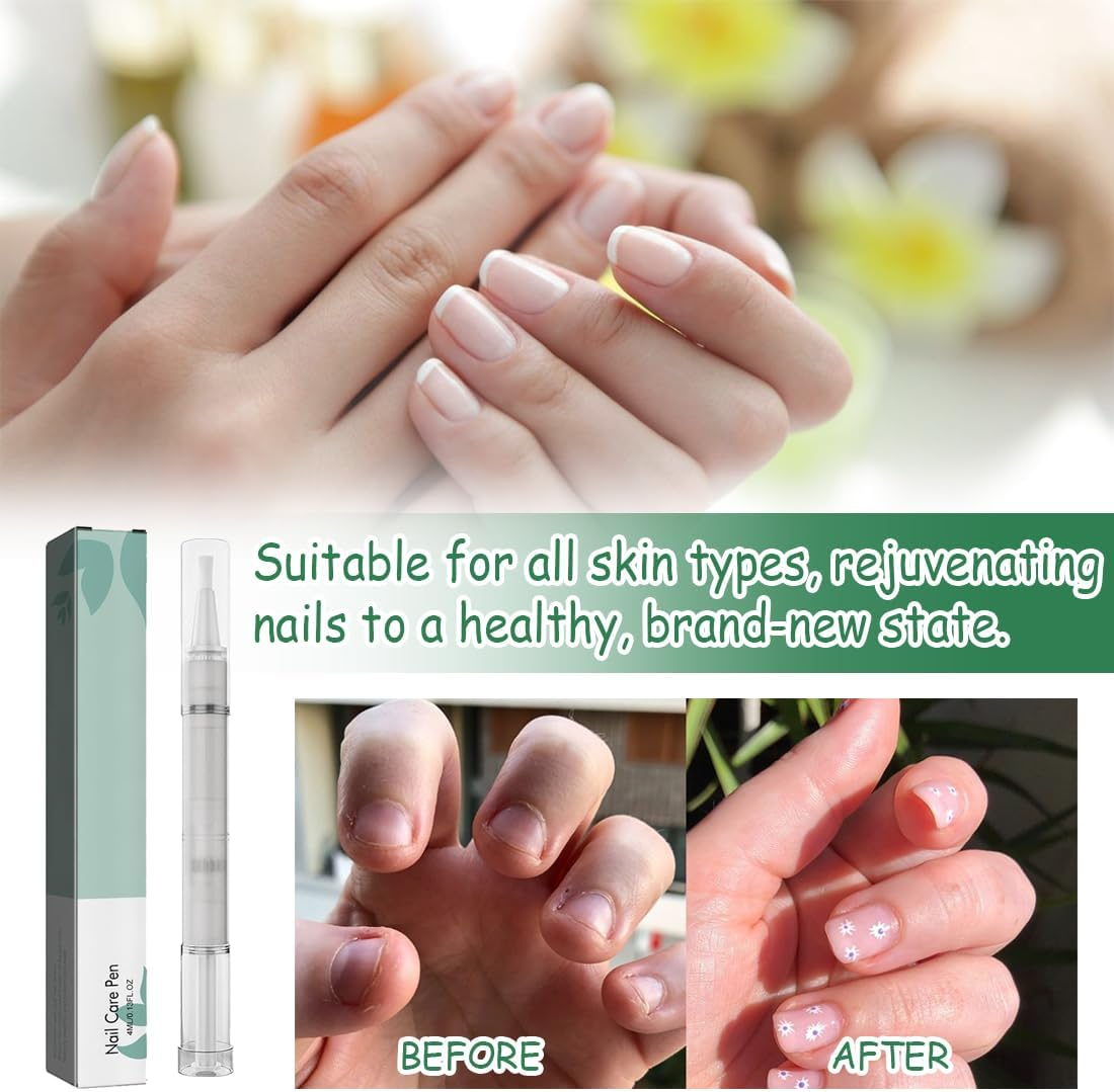 Nail Care Pen, Nail Pen Austria Nail Care Pen &ndash; for Moisturising and Strengthening Nails for Nourished Fingernails Toenails, Easy to Use | Suitable for Everyday Use image number 1