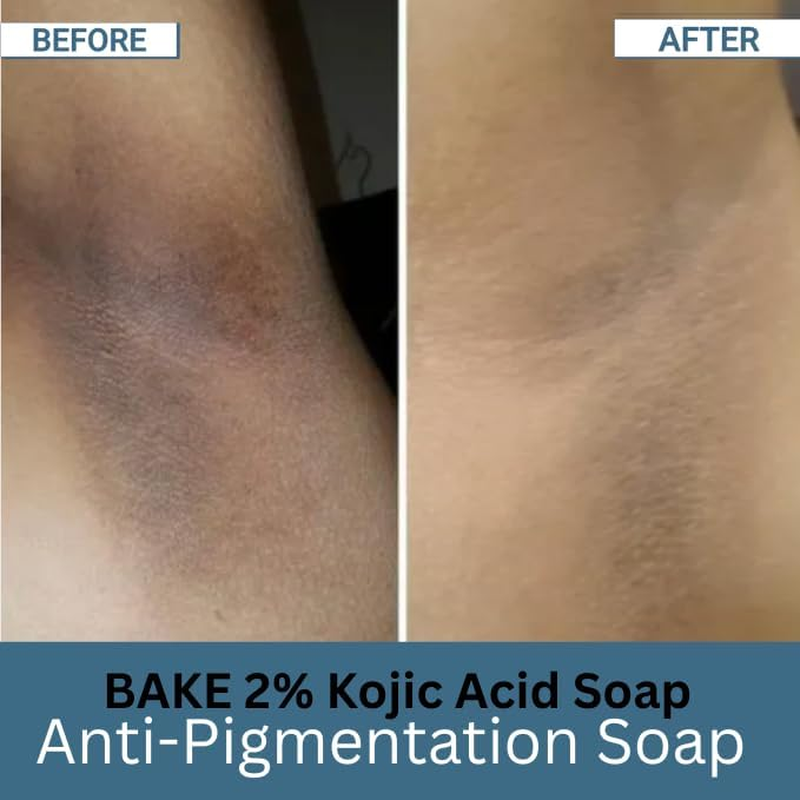 BAKE 2% Kojic Acid Scrub Treatment Soap (100 Gms Pack of 3) with Alpha Arbutin, Lactic Acid & Niacinamide | for Pigmentation, Dark Spots, Tan Removal, Brightens Underarms | Soap for Women & Men | 100G image number 6