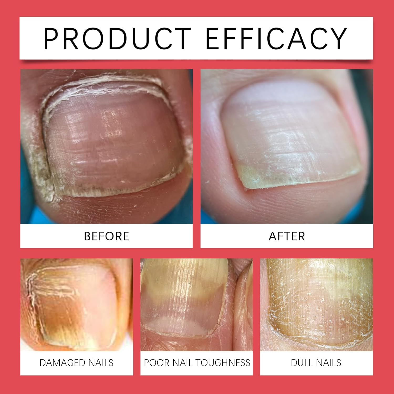 Nail Cuticle Oil Pen 3 Pieces Nail Oil Pen with Manicure Set Nail Care Pen Nail Clippers Set Cuticle Care Oil Nail Care Oil Pen for Care and Repair Dry and Damaged Nails