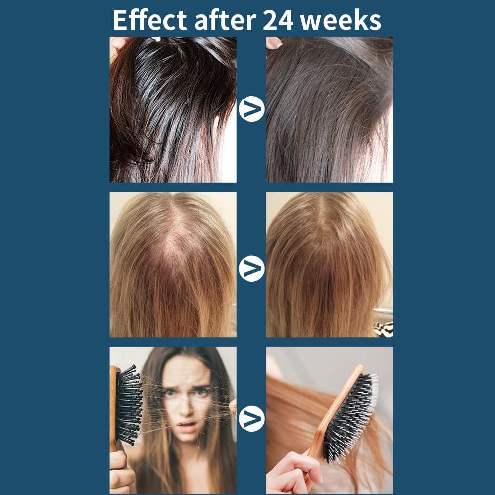 Red Light Hair Growth Beanie, Revitalize Your Hair with the Power Laser Hair Growth Cap, Red Light Laser Hair Growth Cap, Red Light Hair Growth Hat(Black Plug-In) image number 6