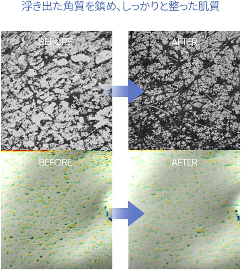 Banilaco Clean It Zero Calming Cleansing Balm, 3.4 Fl Oz (100 Ml), Deer, Hypoallergenic, Redness Care, Ultra Sensitive Skin