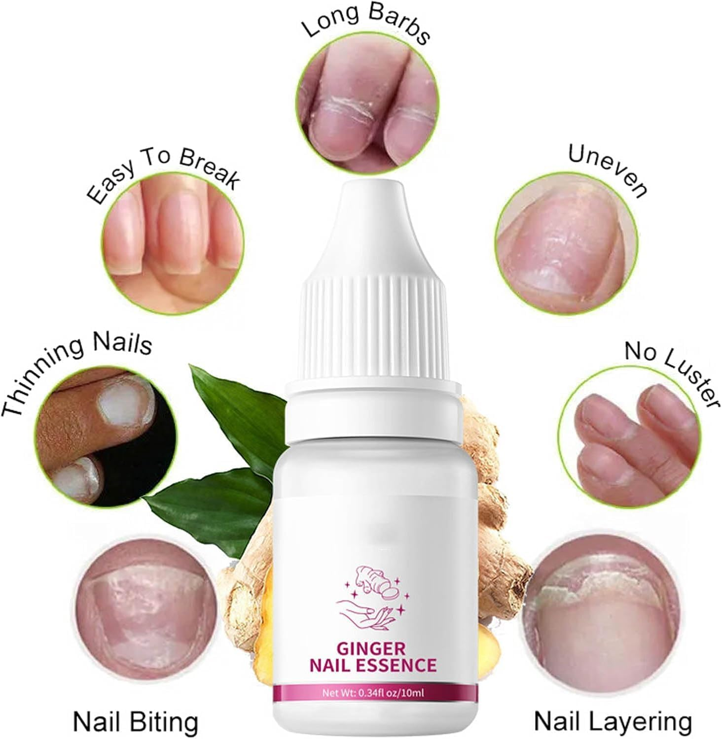 Fungigone Nail Treatment, Fungigone Nail Fungus Removal, 7 Days Nail Fungus Treatment for Toenail, Foot F-Ungus Treatments Nails Care Solution for Toenails & Fingernails (3 PC) - 2 Pc image number 5