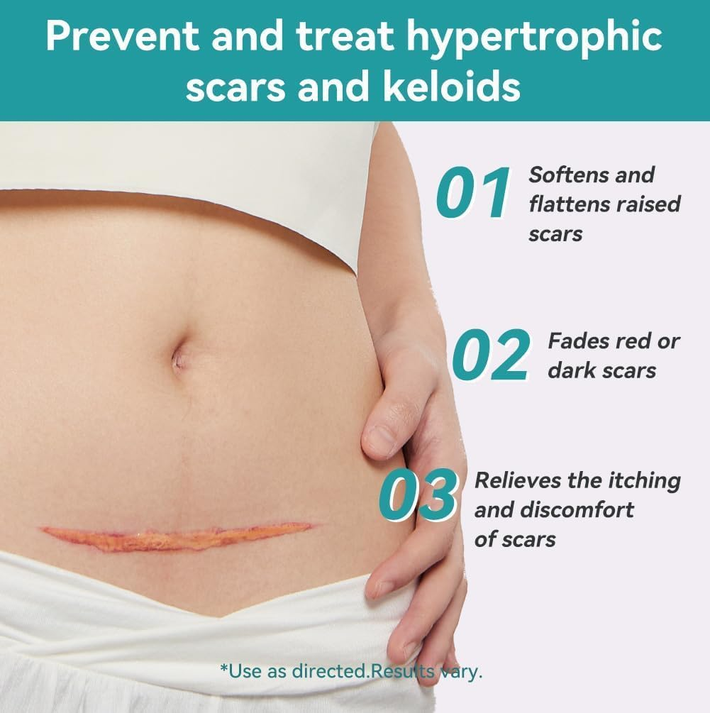 Dimora Medical Grade Silicone Scar Sheets - Ultra Soft Silicone Scar Tape (4Cmx3M), Waterproof Scar Treatment for Surgical Scars, C Section, Tummy Tuck, Keloid Treatment image number 1