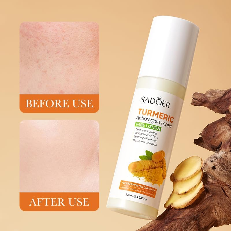 Turmeric Antioxidant Repair Face Lotion, Moisturising, Soothing,120Ml image number 5