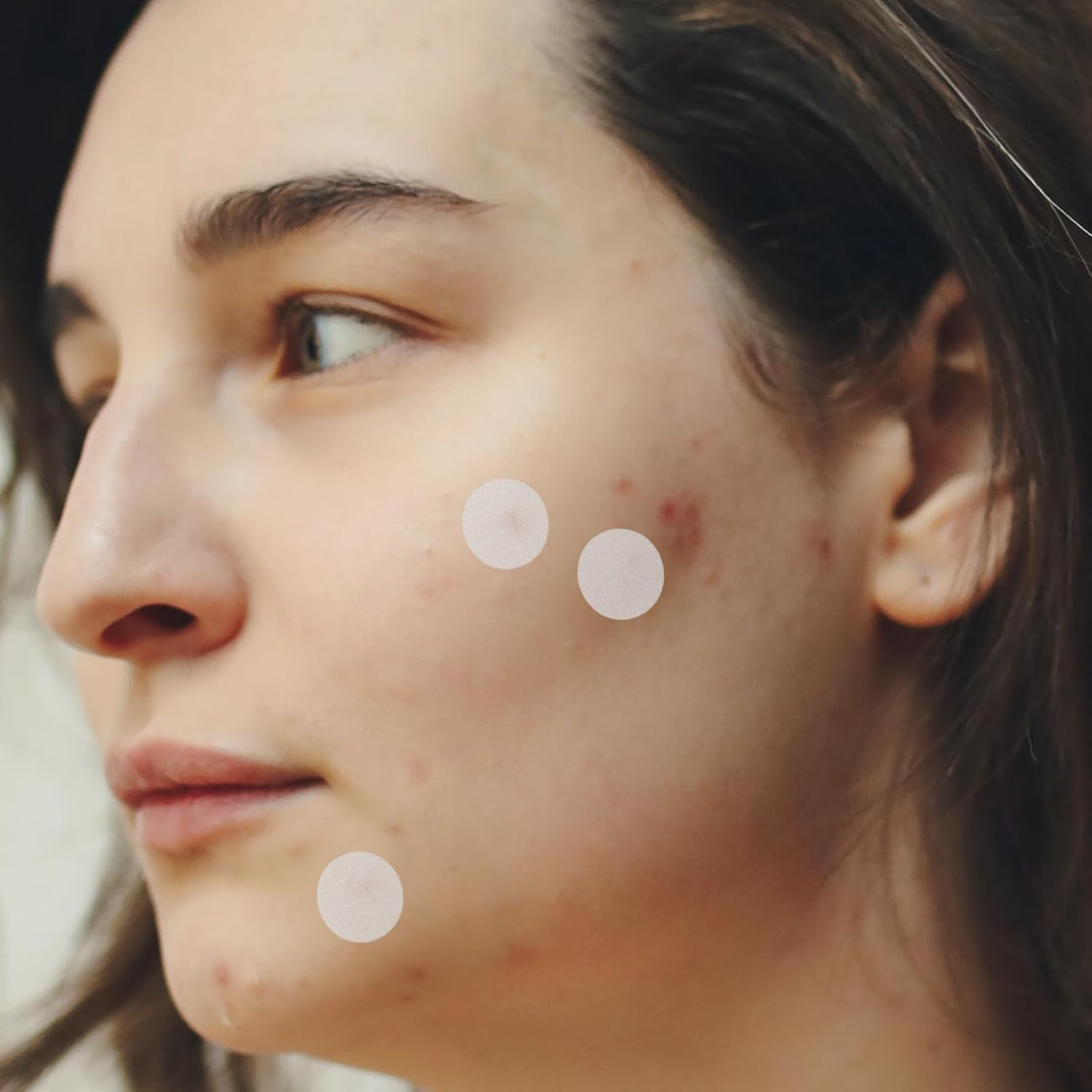 480 Pcs Mole Patch Stickers Labels Remover Patch Mole Remove Patch Wart Skin Patches Face Patches Facial Mole Patches Skin Patches Accessories Glue Peeled image number 3