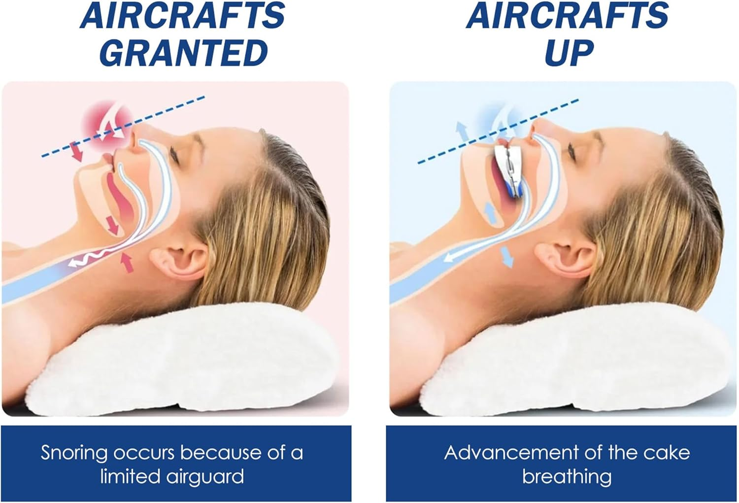 Mouth Guard for Teeth Grinding with anti Bruxism Sleeping Aid Mouth Guard for Men/Women a Better Night'S Sleep Bring Braces Box image number 6