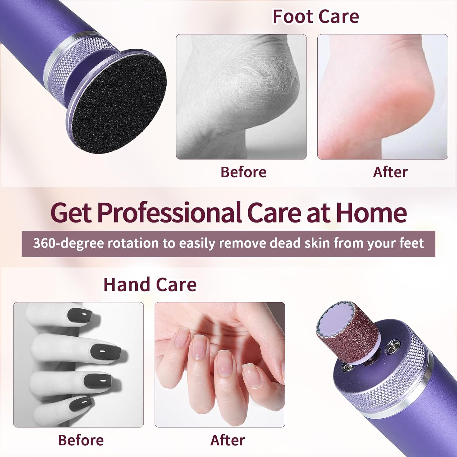2-In-1 Electric Callus Remover, 6 Adjustable Electric Callus Remover with Replaceable Foot Files, Rechargeable Professional Callus Remover for Feet, Heels, Callus, Purple image number 4