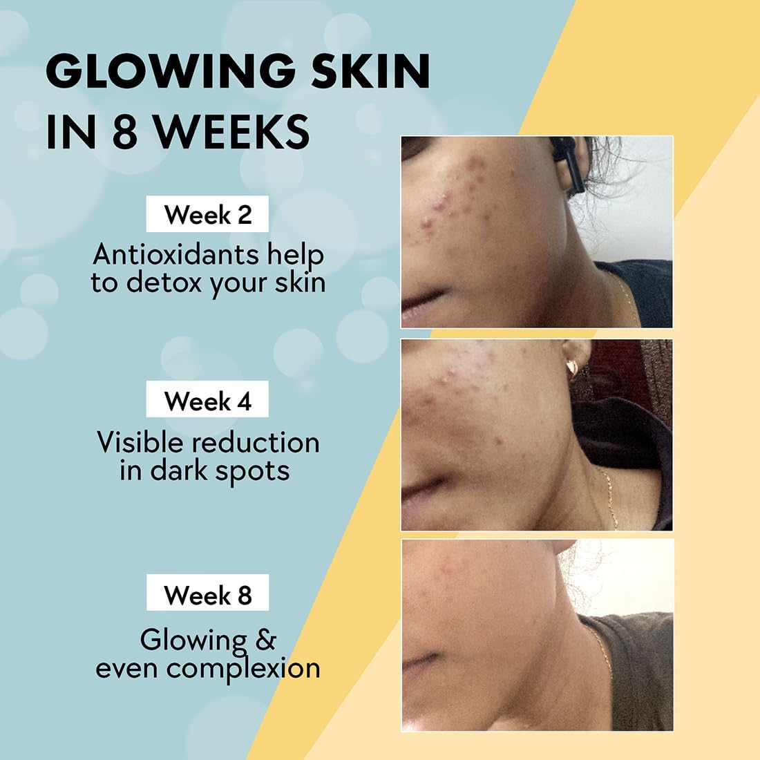 Chicnutrix Glow Effervescent Tablets, Japanese Glutathione 500Mg with Vitamin C, Strawberry-Lemon Flavour, 20 Tablets