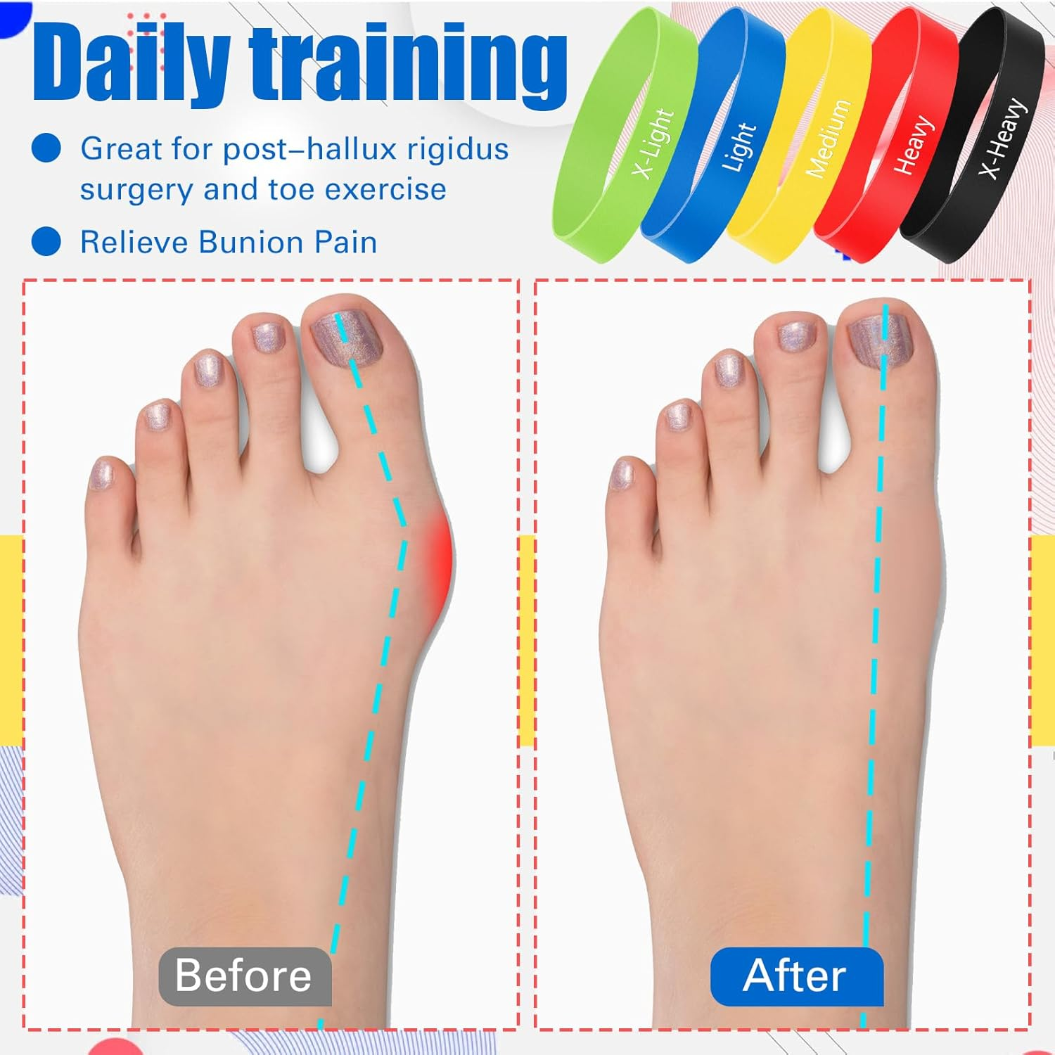 Set of 5 Toe Bands Toe Stretcher Bands Resistance Toe Bands with Carry Bag for Correct Alignment Ankle Exercise Foot Strengthening (Multicolor) image number 2