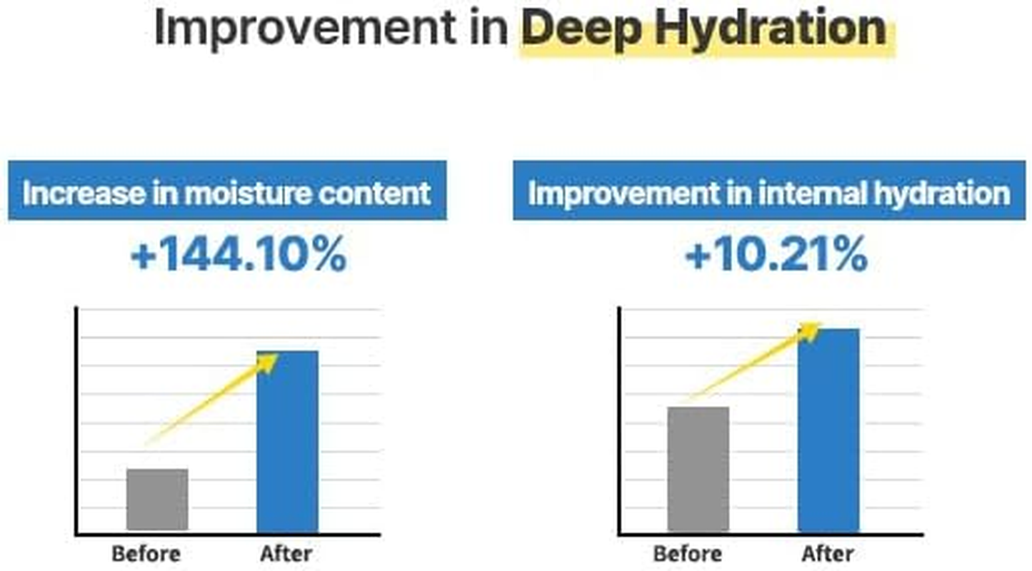 S.NATURE AQUA SQUALANE Serum｜Sebum Control, Pore Care, Inner Moisture, Calming｜1.69 Fl.Oz, 50Ml