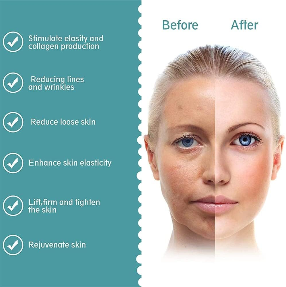 NEW Mini HIFU Machine Ultrasound Machine RF Fadiofrecuencia EMS Microcurrent Lift Firm Tightening Skin Wrinkle Skin Care Product (White) image number 6