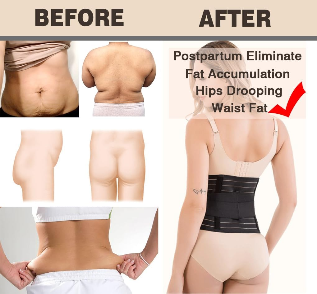 Vivva Belly Band Recovery Support Belt Wrap- Post Partum Girdles Tummy Bandit Binder - Postnatal Abdomen Pelvic Compression Corset Binding Body Shaper Shapewear image number 5