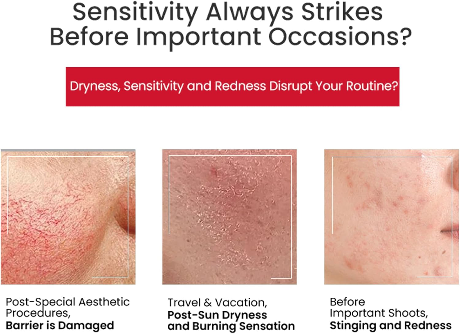 WINONA Collagen Sheet Mask 6Pcs, Instant Repair & Brightening, Soothing Quick-Repairing Freeze-Dried Collagen Mask + Solvent for Sensitive Skin, Alleviating Redness, Improving Skin Tolerance image number 2