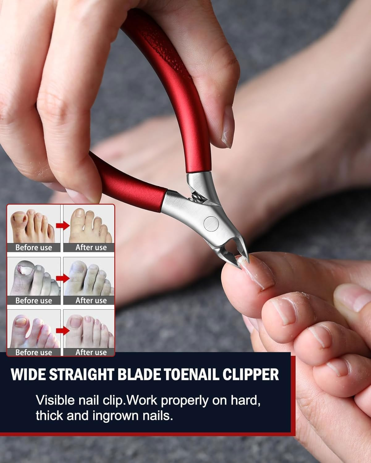 FUGLUS Toe Nail Clippers, Large, Professional Nail Clippers, Toenails for Seniors, Thick Nails with Wide Opening, Sharp Nail Clipper, Long Handle, with Nail Stripper and Nail File image number 1