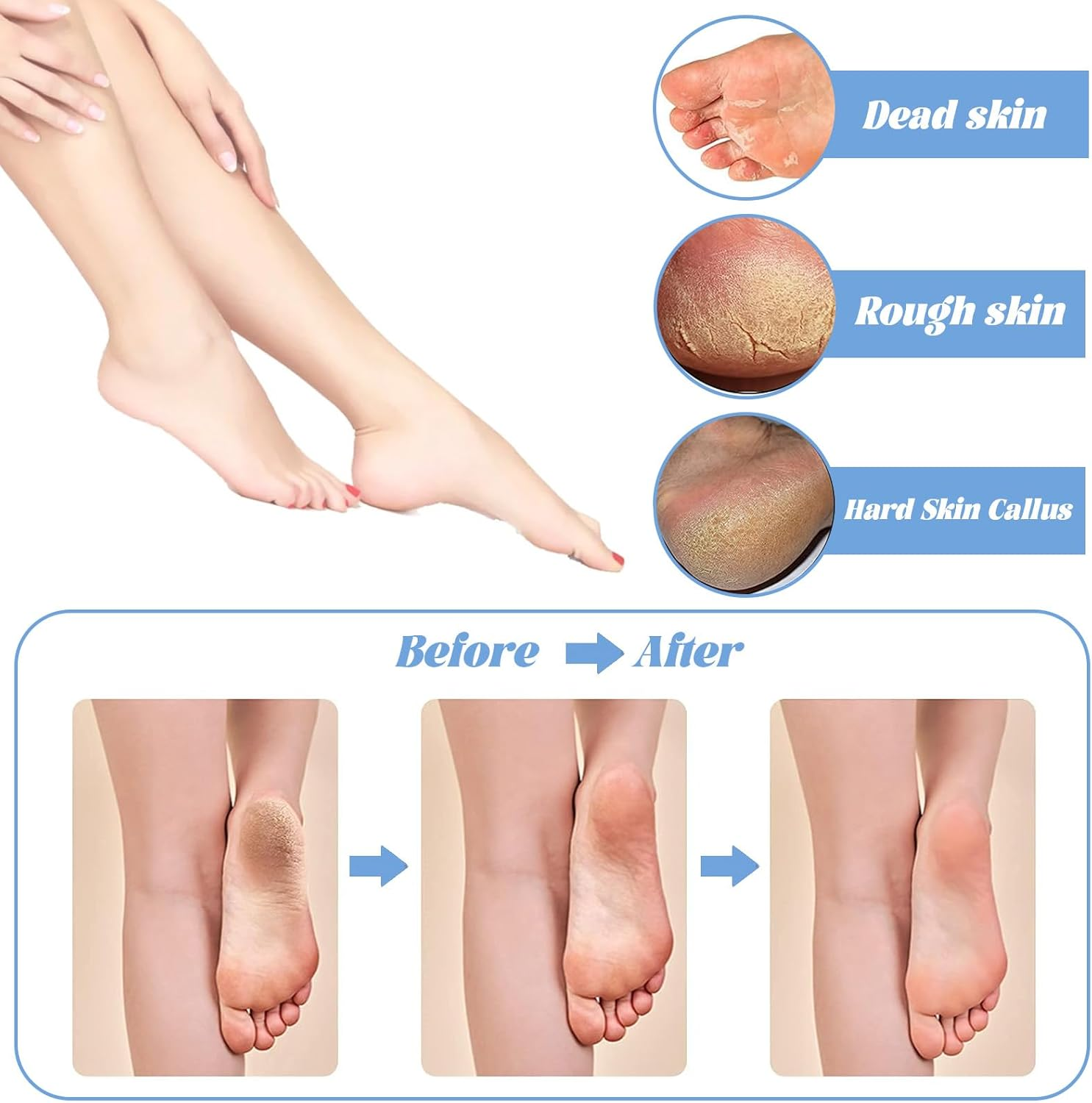2Pcs Pumice Stone,Pumice Stone for Feet,Pedicure Tools,Foot Pumice,Foot Pumice Stones,Callus Remover Scrubber Skin Cleaner (Blue) image number 2